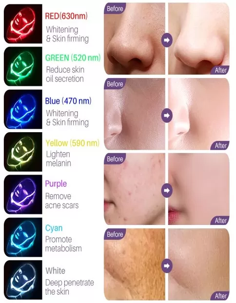 Face LED Mask